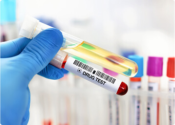 Randomdrugtesting