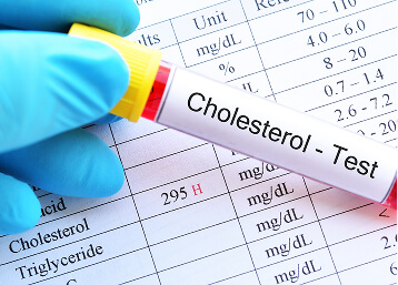 Cholesterol