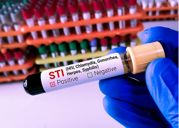 Sti